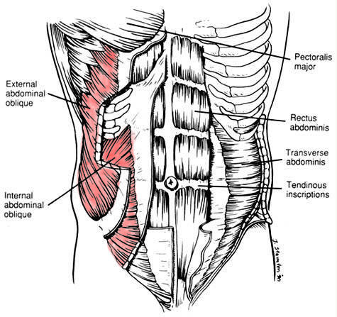 External Internal Abdominal Oblique pectus carinatum workout and exercise